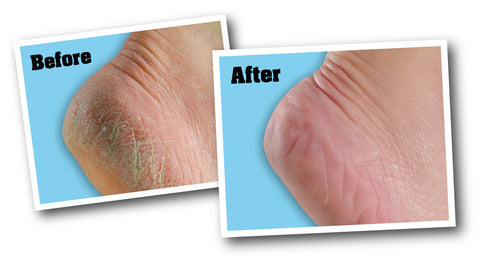 O'Keeffe's For Healthy Feet Foot Cream