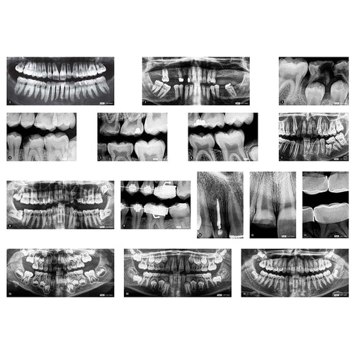 Roylco Dental X-Rays